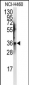 JTV1 Antibody (Center)